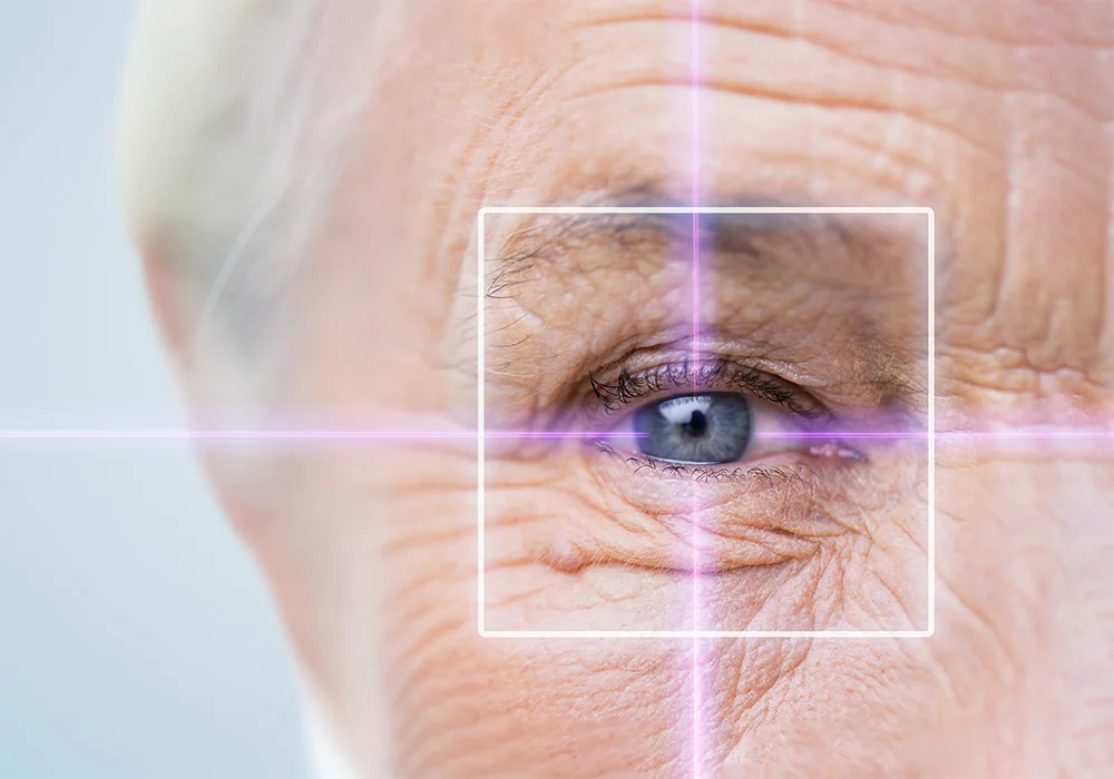 senior woman and laser cataract surgery concept